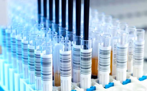 新型冠状病毒检测试剂欧盟注册和欧盟自由销售证书申请多少钱